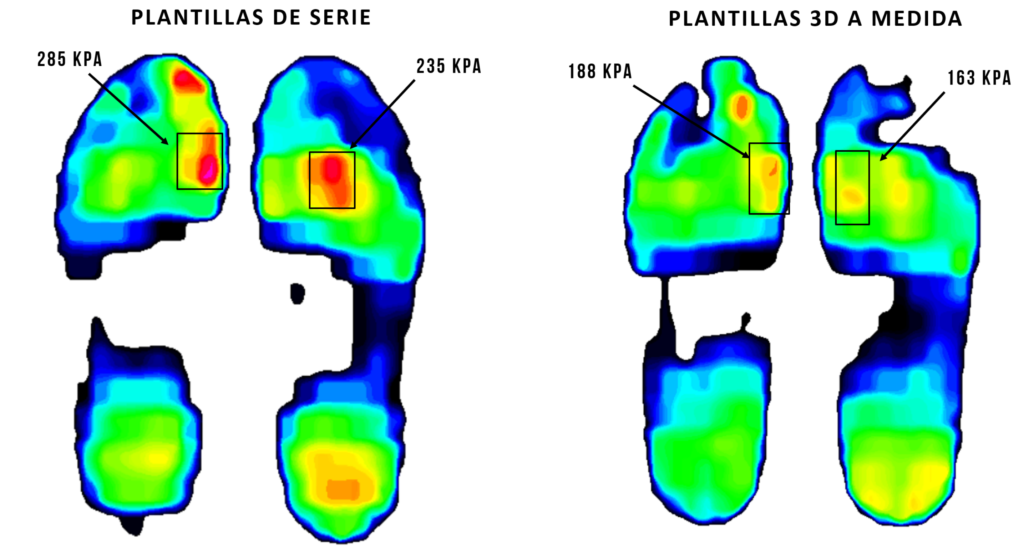 CASO 3 DIABETICO