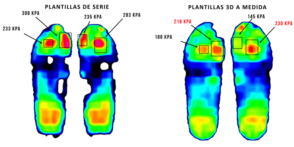 CASO 4 DIABETICO